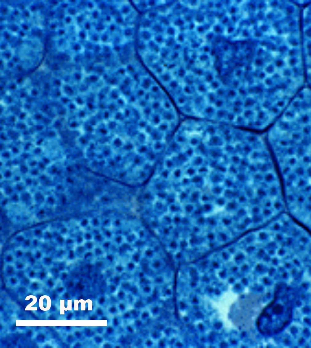 Annexe bactéroïdes.jpg