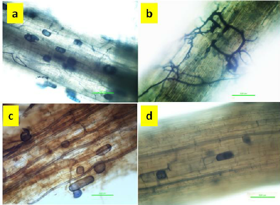 Annexe Glomus-intraradices-colonisation-6-months-from-inoculation-Roots-of-GF677-a.png